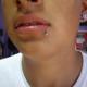 labio inferior